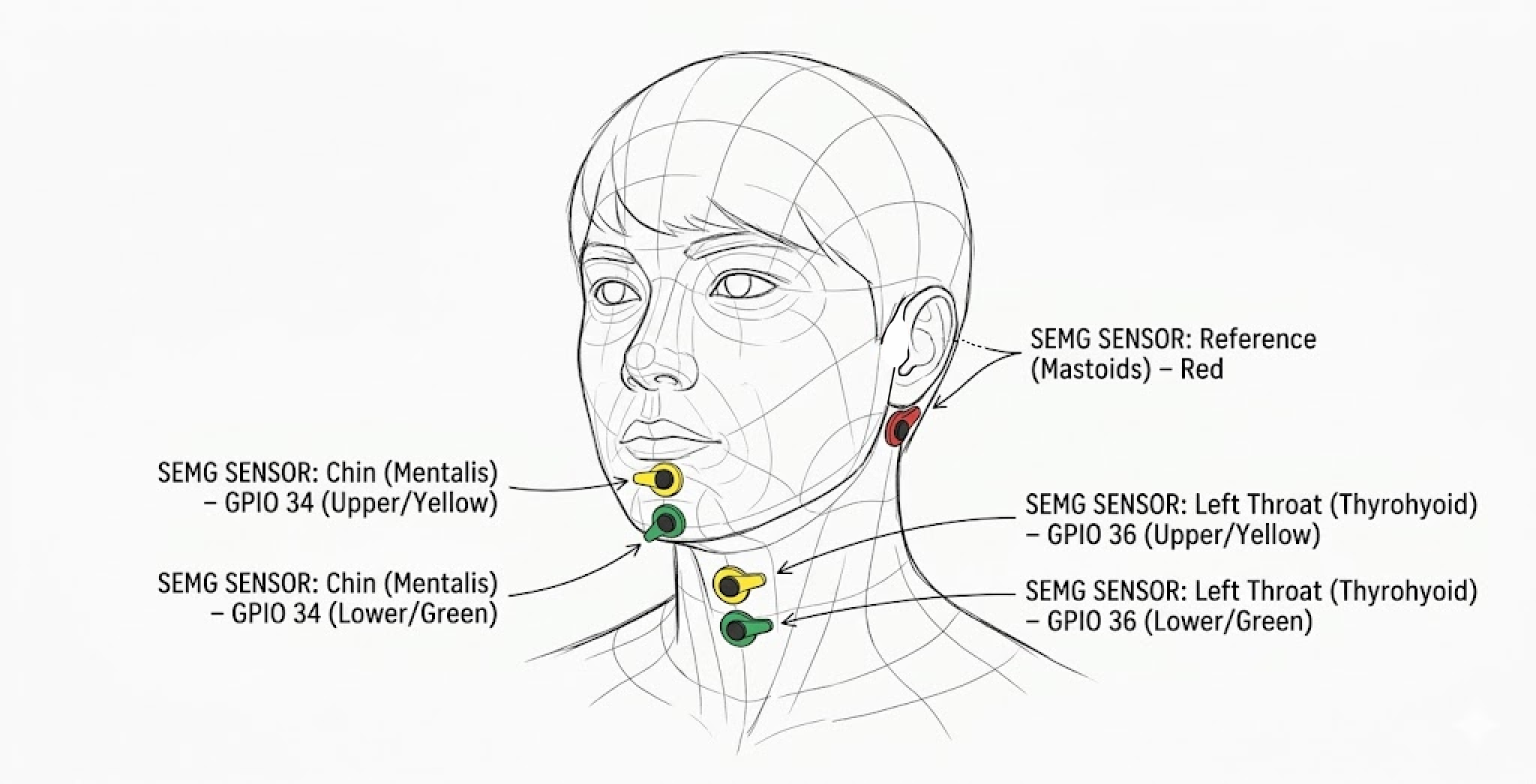 sEMG electrode placement diagram showing chin (Mentalis, GPIO 34), left throat (Thyrohyoid, GPIO 36), and mastoid reference positions